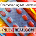 Überdosierung Mit Tadalafil 06